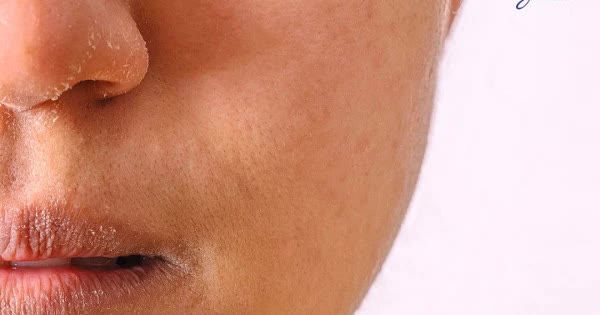 Dấu hiệu cho thấy cơ thể thiếu nước trầm trọng